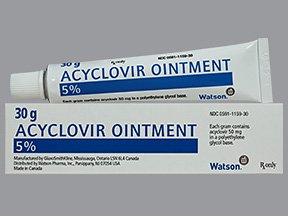 do you need a prescription for aciclovir uk